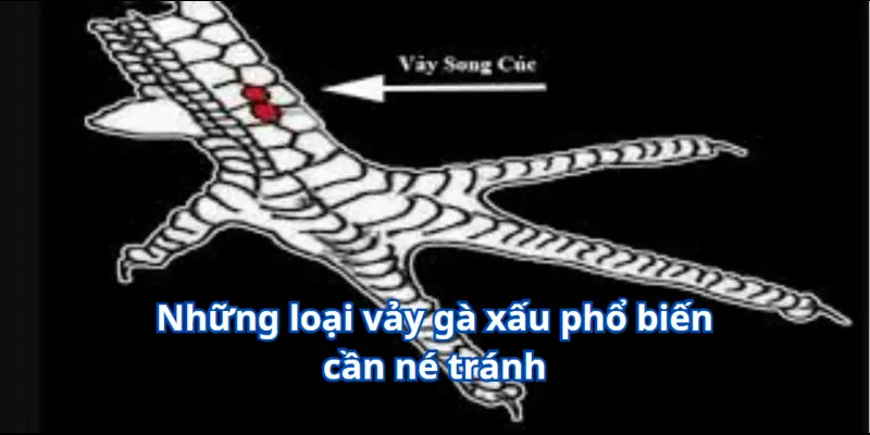 Những loại vảy gà xấu phổ biến cần né tránh